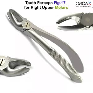 Fig 17 Right Upper Molars
